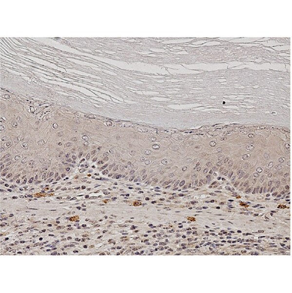 IHC of mouse forestomach squamous epithelium labeled with DSHB antibody C651.6DbHN against Notch2 intracellular domain. PMID: 31276933, Fig. 5D.